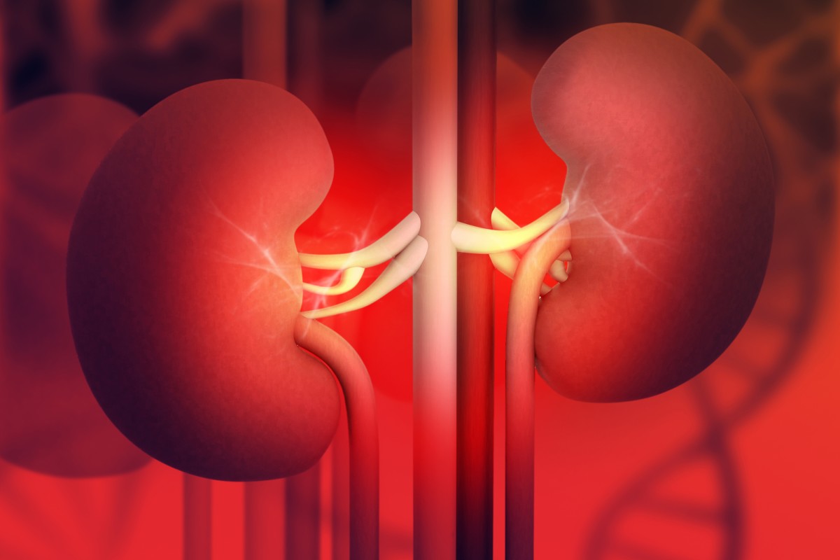 Renal Transplant